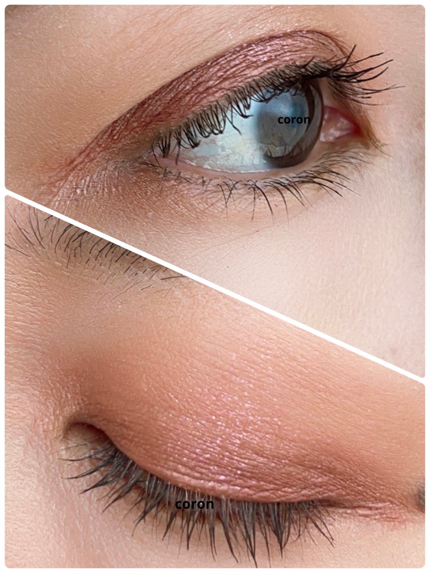 ã¢ãã£ã¯ã·ã§ã³ ã¶ ã¢ã€ã·ã£ã㊠ã¹ããŒã¯ã«/ADDICTION/åè²ã¢ã€ã·ã£ããŠã䜿ã£ãã¯ãã³ãïŒ2æç®ïŒ