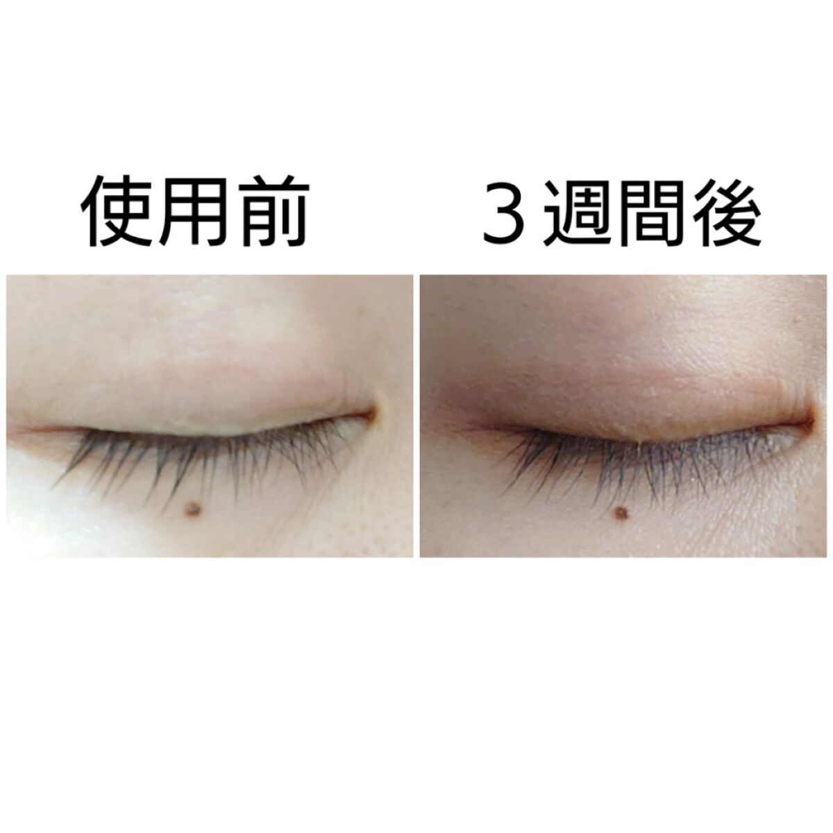 ラッシュアディクト アイラッシュコンディショニングセラム/soaddicted/まつげ美容液を使ったクチコミ（2枚目）