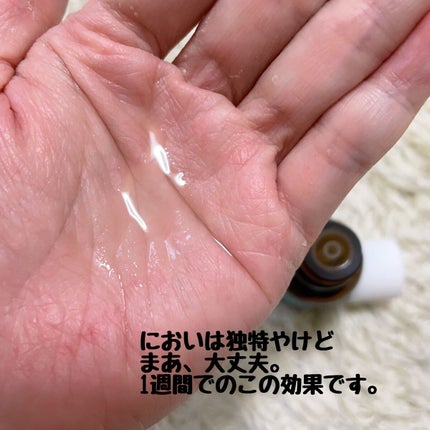 マジックティーツリーオイル/ブラン/フェイスオイルを使ったクチコミ(3枚目)