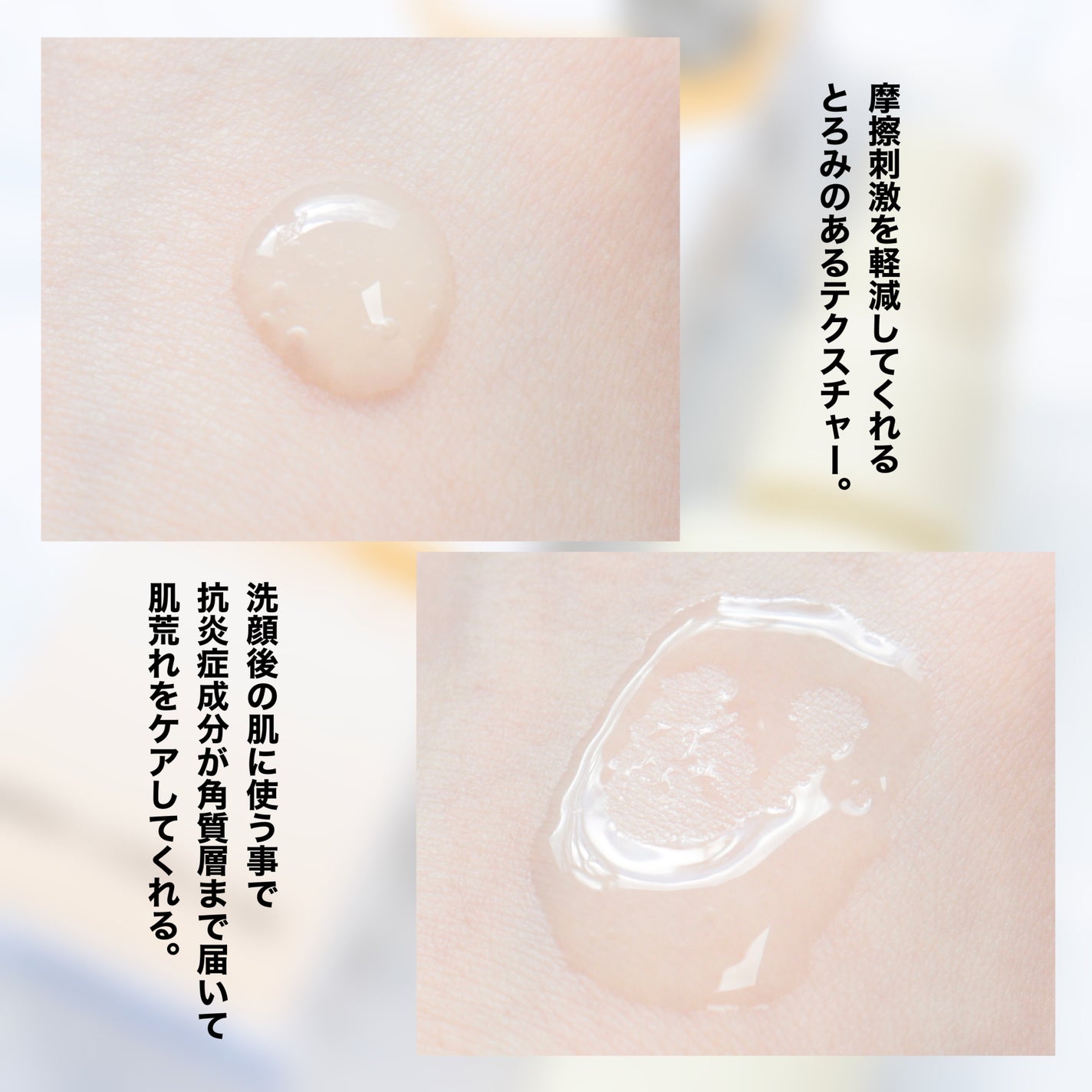 スキントラブルケア リキッド/アルージェ/美容液を使ったクチコミ(4枚目)