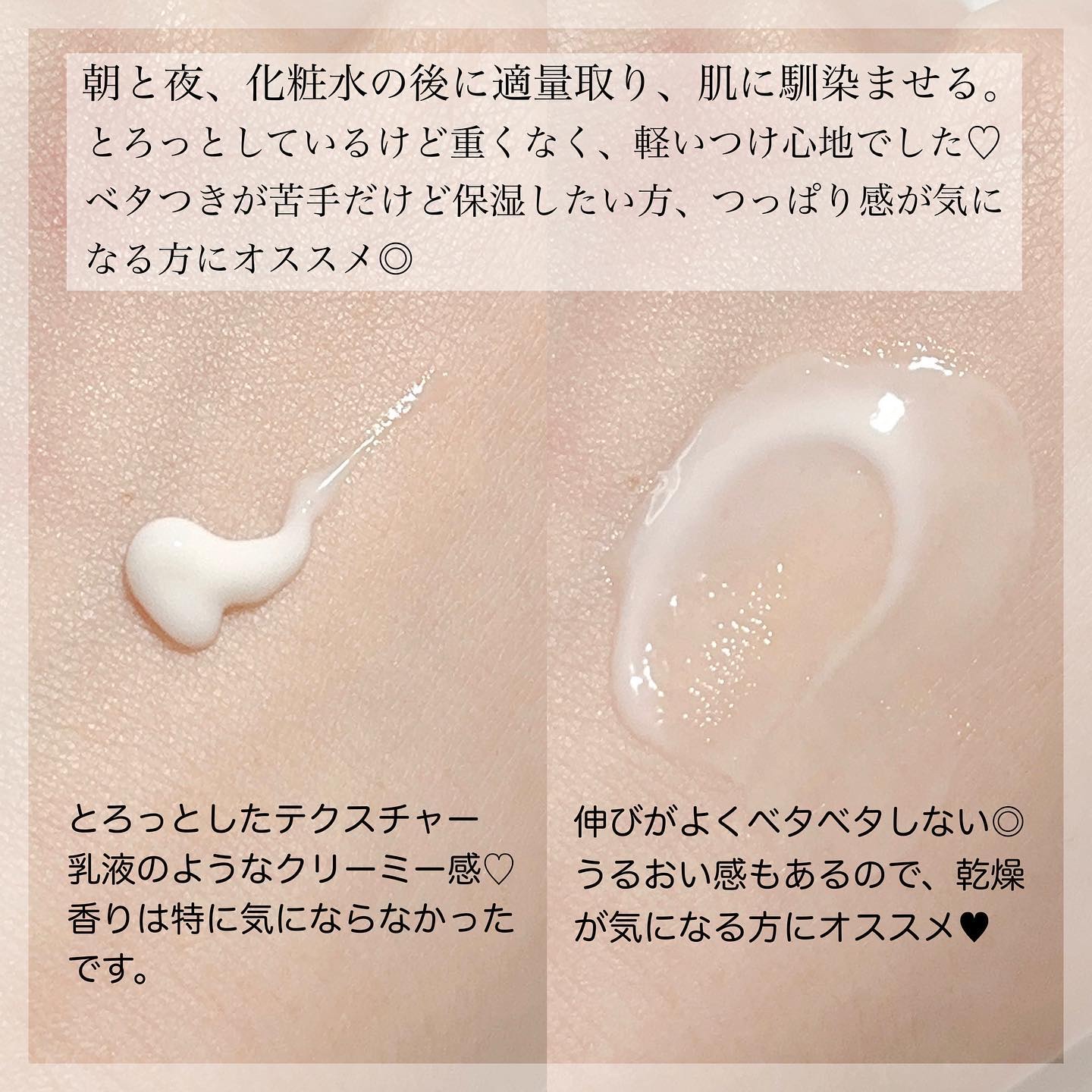 チーズフォンデュうるツヤセラム/Julioly/美容液を使ったクチコミ（2枚目）