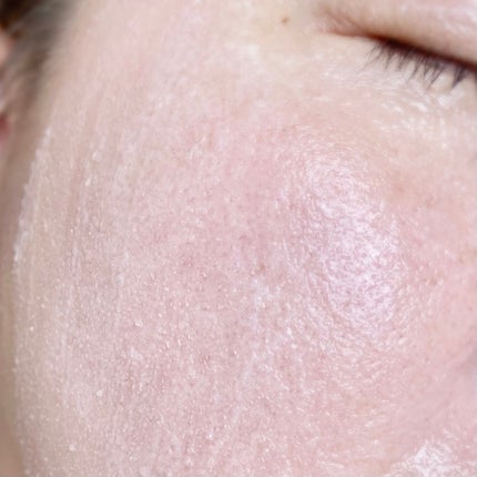 ピンクティーツリーライスシカウォッシュオフパック/APLIN/洗い流すパック・マスクを使ったクチコミ(5枚目)