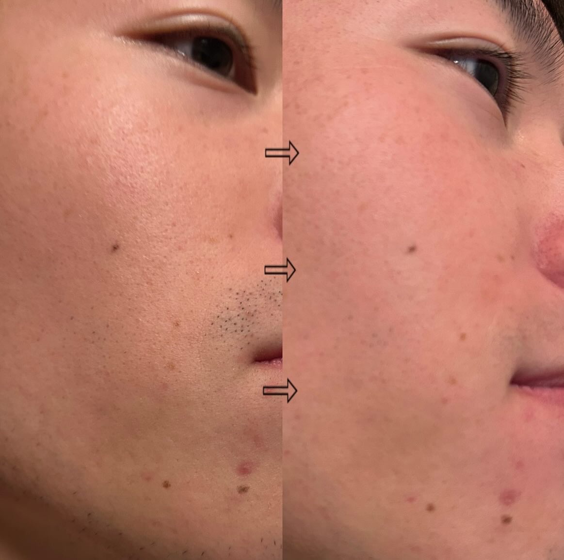 easy 薬用 ハイブリッド アフターミスト シトラスウッドの香り/MARO/ミスト状化粧水を使ったクチコミ（3枚目）