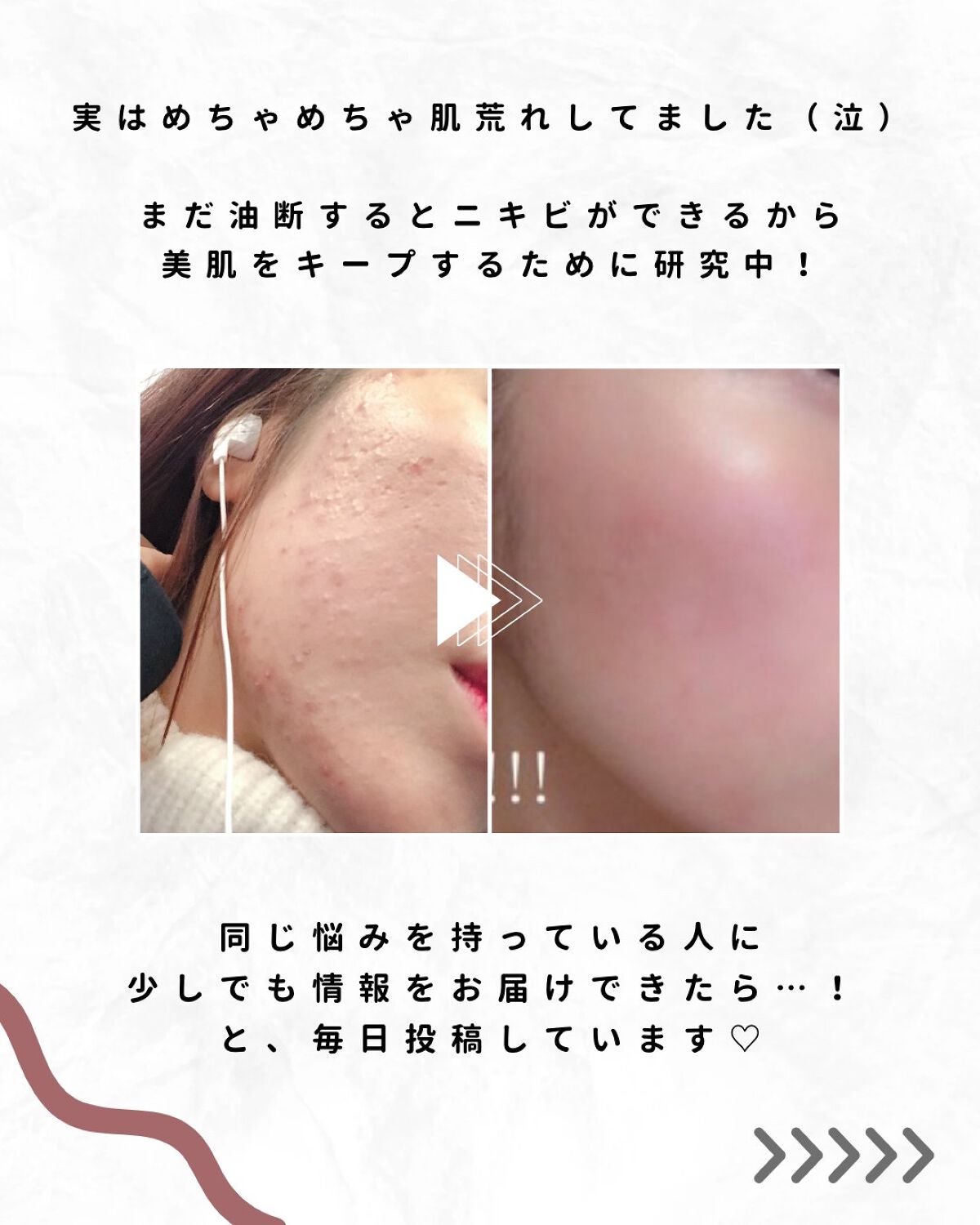 ãªãŒãð«§ãããã»èèããçŸèã« on LIPS ãèèãããŠãããšãã«ç§ããã£ãŠããããšãŸãšãð«§1çªã²ã©ããšãã®..ãïŒ2æç®ïŒ