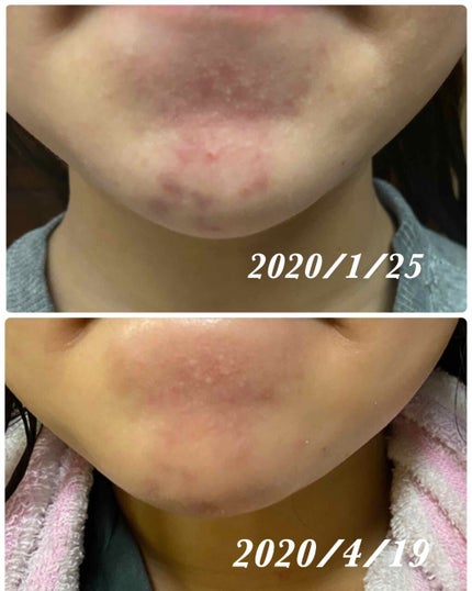 乳液・敏感肌用・しっとりタイプ/無印良品/乳液を使ったクチコミ(4枚目)