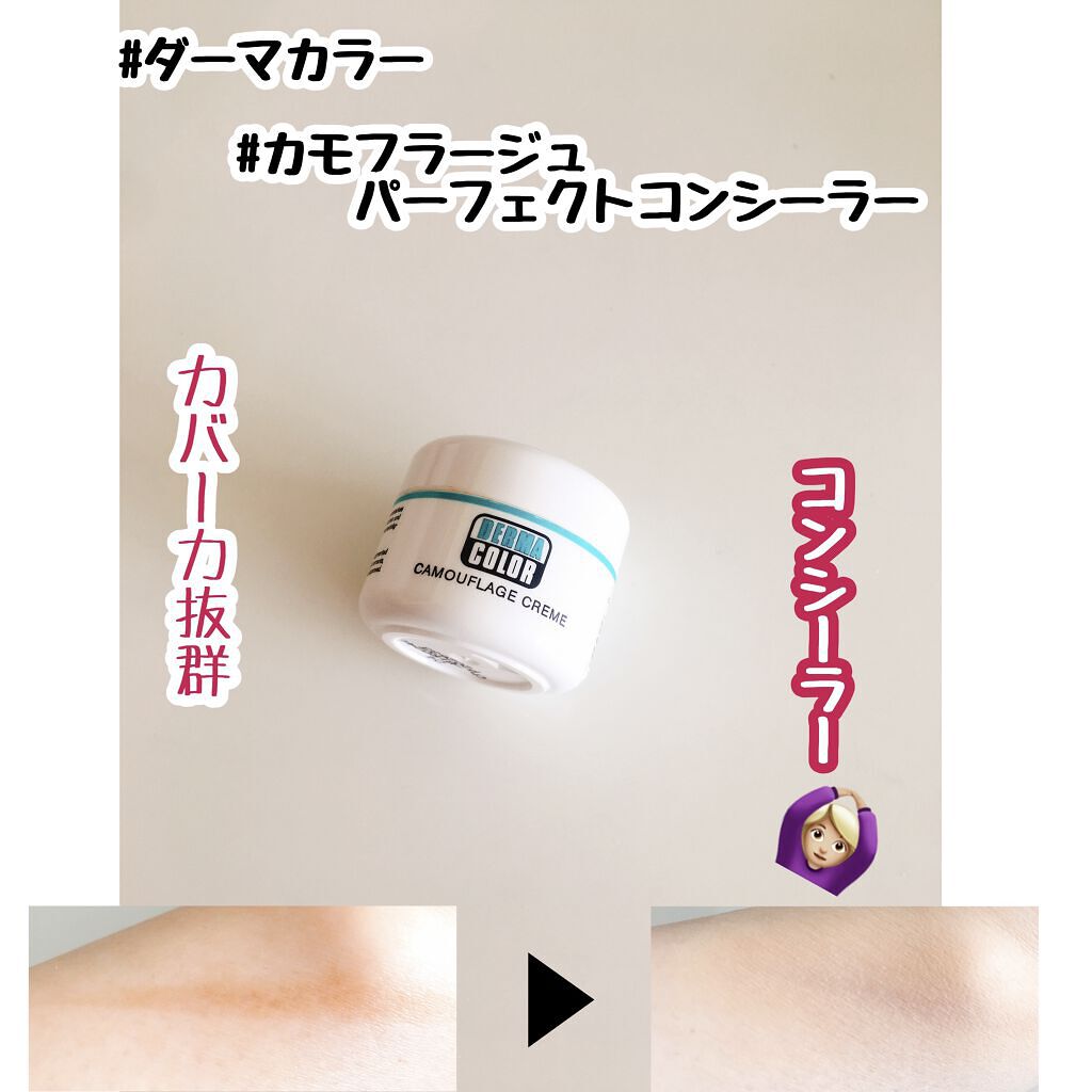 送料無料 ダーマカラーパーフェクトコンシーラー アザ上手にカモフラージュ クマ 全国宅配無料 クマ