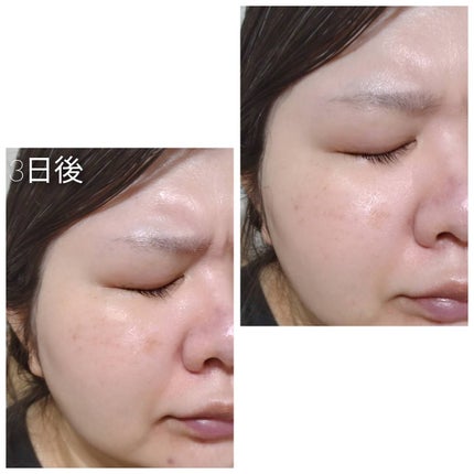 リードルショット100/VT/美容液を使ったクチコミ(4枚目)