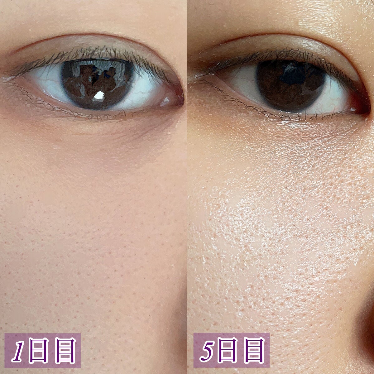 レチノールインテンシブ アドバンスドトリプルアクションアイクリーム/SOME BY MI/アイケア・アイクリームを使ったクチコミ(9枚目)