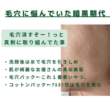 美肌カウンセラー💆綺麗のお助け相談所 on LIPS 「肌を綺麗にする専門家💆美肌カウンセラーおすすめ＼毛穴の悩みは改..」（2枚目）