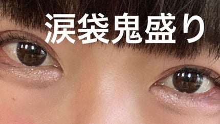 コンシーラーS/media/クリームコンシーラーを使ったクチコミ(1枚目)