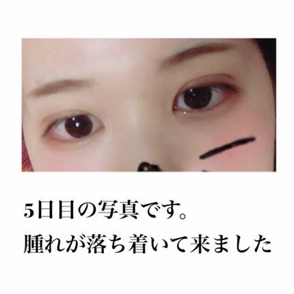 äºéæŽåœ¢/ãã®ä»ã䜿ã£ãã¯ãã³ãïŒ3æç®ïŒ