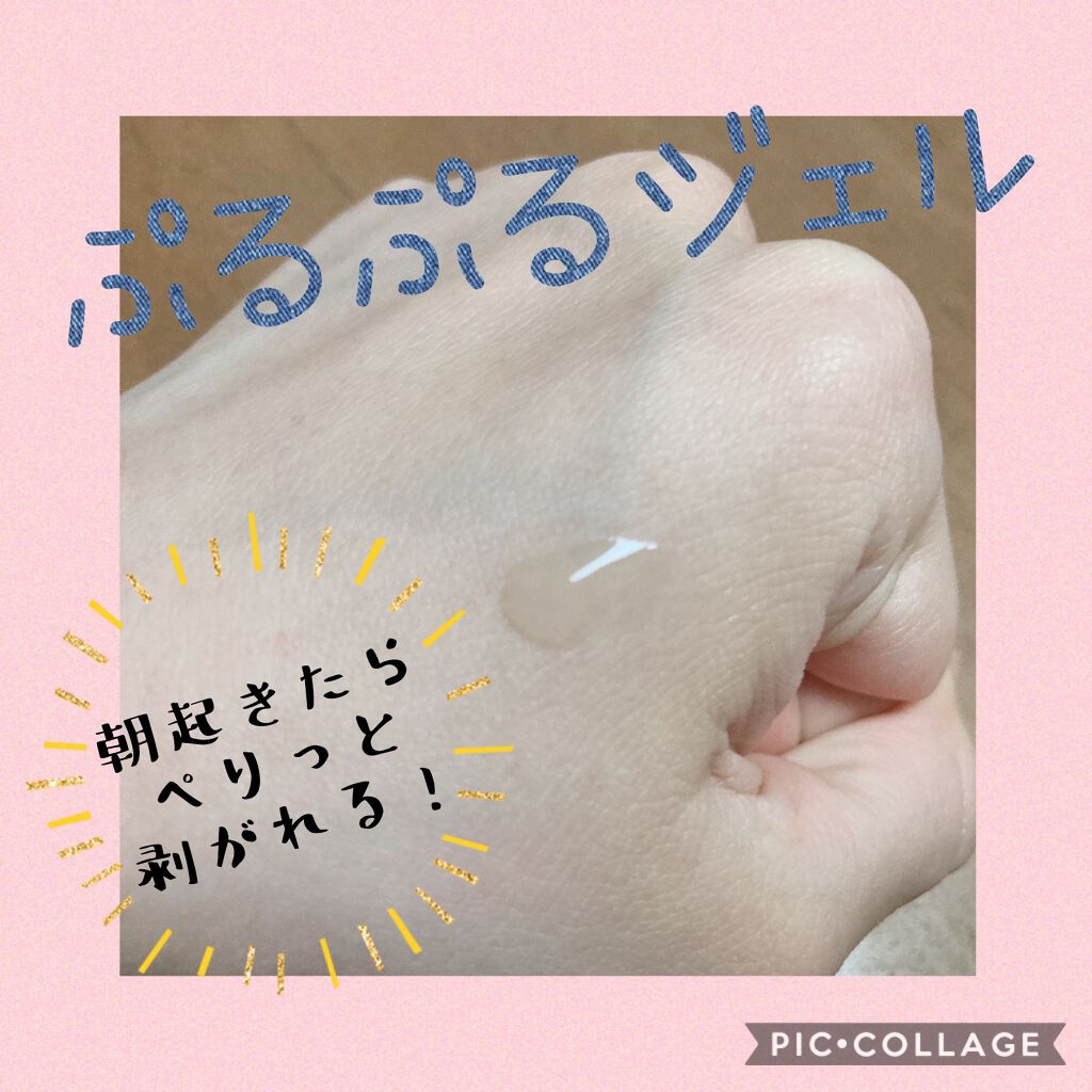 ニキビあとケアジェル/アットノン/その他スキンケアを使ったクチコミ（2枚目）