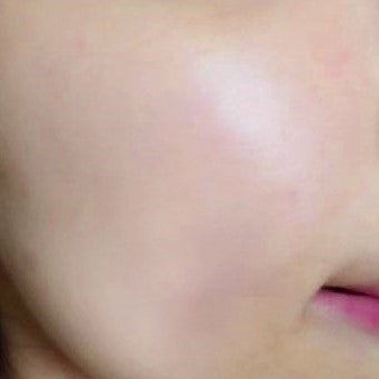 ボツルショット100/CELLINSHOT/ブースター・導入液を使ったクチコミ(2枚目)