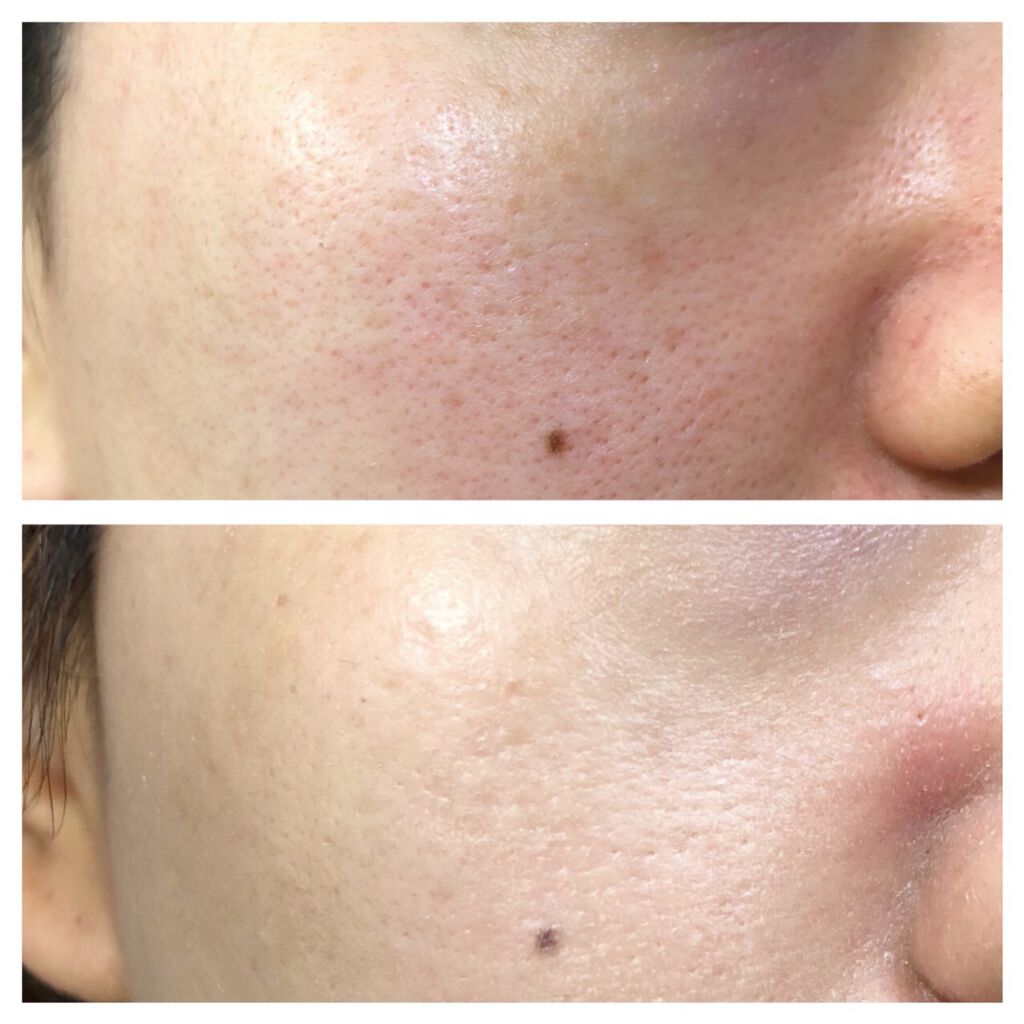 ドラマティック ヌードジェリーBB/マキアージュ/BBクリームを使ったクチコミ(4枚目)