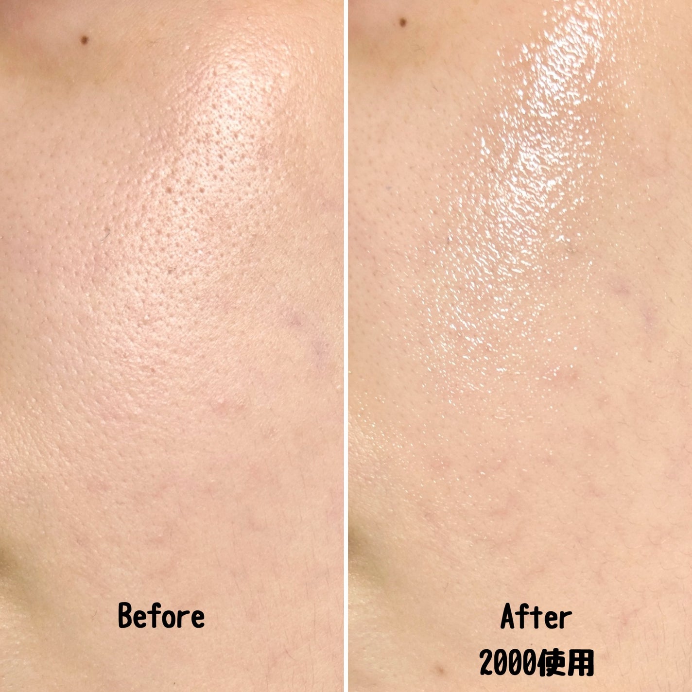 ゼロ1DAYエクソソームショット2000/MEDICUBE/美容液を使ったクチコミ(3枚目)