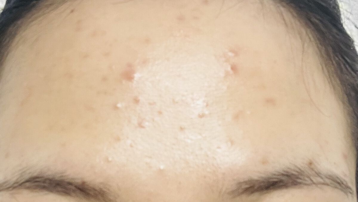 ザビタミンC23/IOPE/美容液を使ったクチコミ（3枚目）