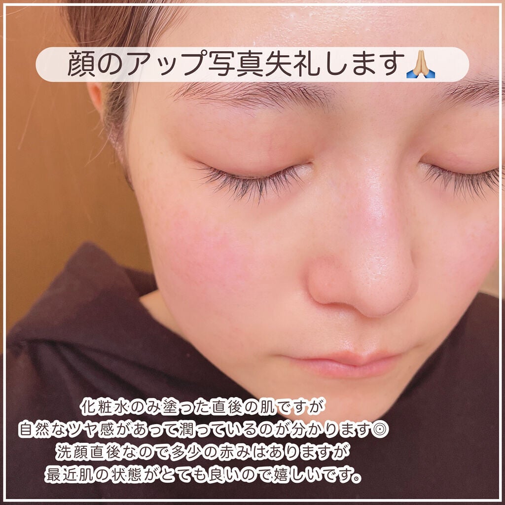 フルフィットプロポリスシナジートナー/COSRX/化粧水を使ったクチコミ(5枚目)