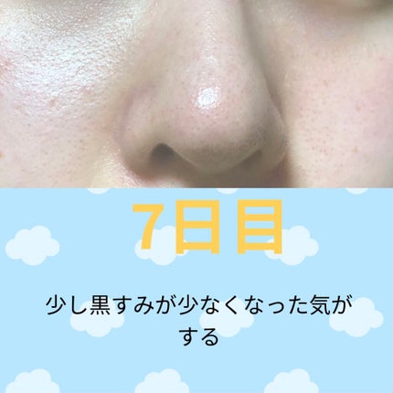 ゼロ毛穴パッド 2.0/MEDICUBE/トナーパッドを使ったクチコミ(3枚目)