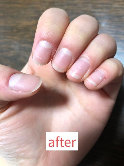 甘皮切りセット/キャンドゥ/ネイル用品を使ったクチコミ(4枚目)