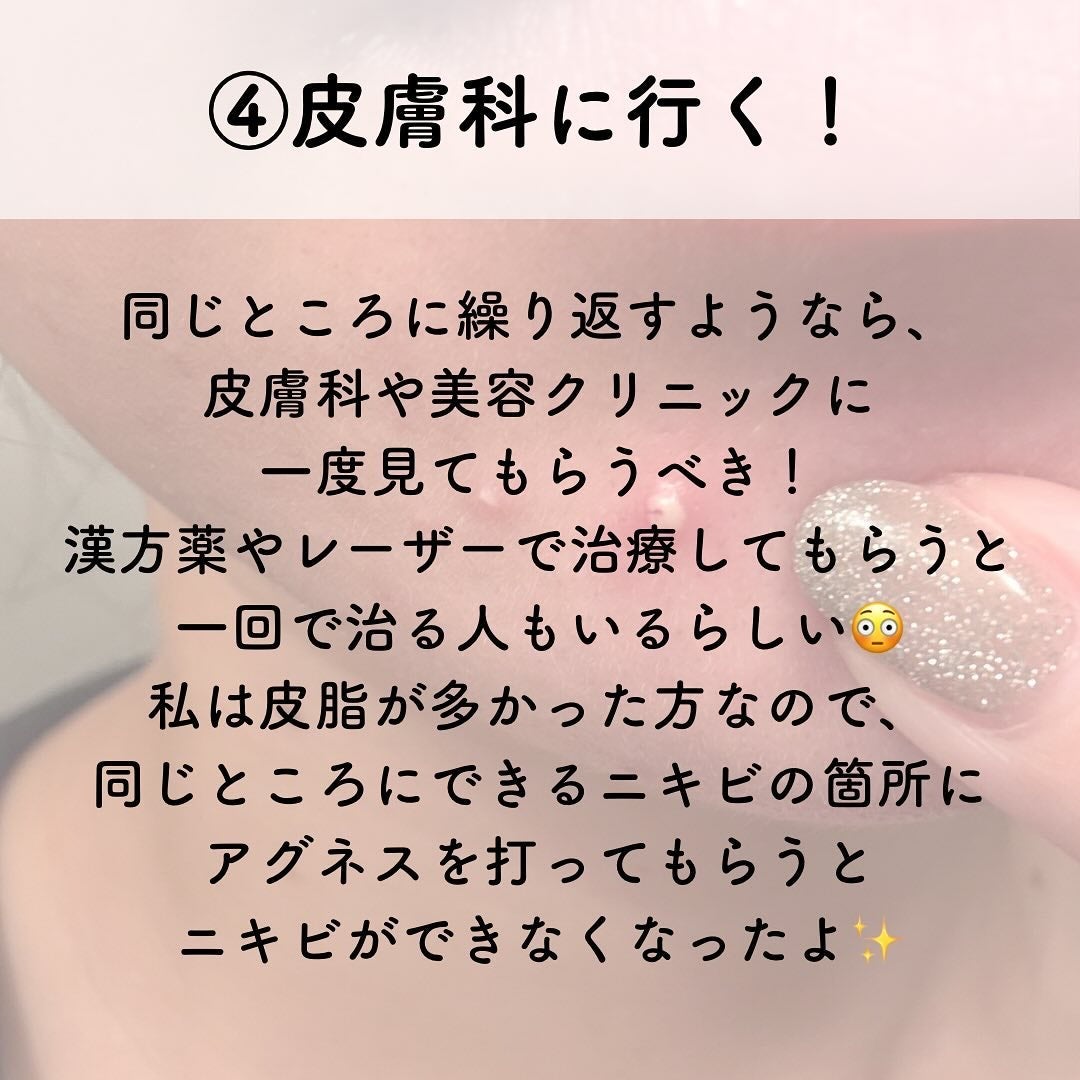 プロCICA クリアスポットパッチ/VT/その他スキンケアを使ったクチコミ(3枚目)