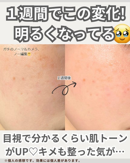 マリンPDRNデイリーシートマスク/ネイチャーリパブリック/シートマスク・パックを使ったクチコミ(5枚目)