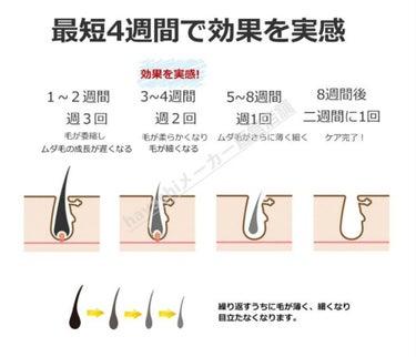 beyda IPL光脱毛器/beyda/家庭用脱毛器を使ったクチコミ（3枚目）