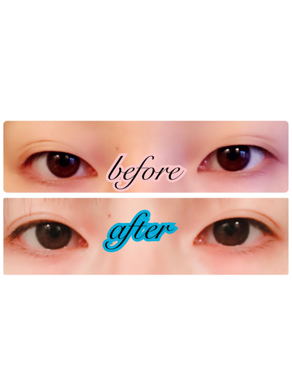 ナイトアイボーテ/StreeTrend/二重まぶた用アイテムを使ったクチコミ（2枚目）