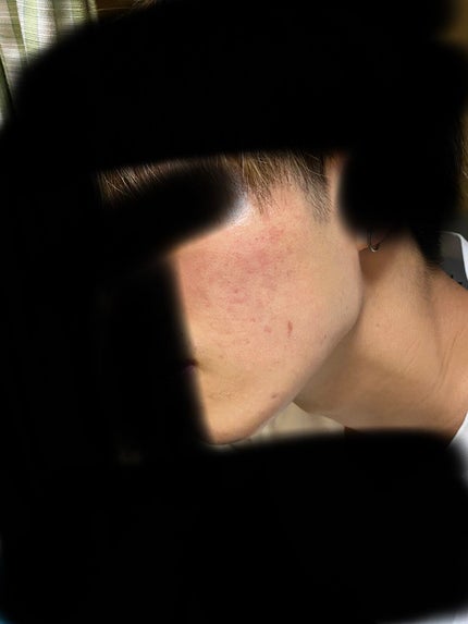 サンホワイトP-1/サンホワイト/ボディクリームを使ったクチコミ(1枚目)