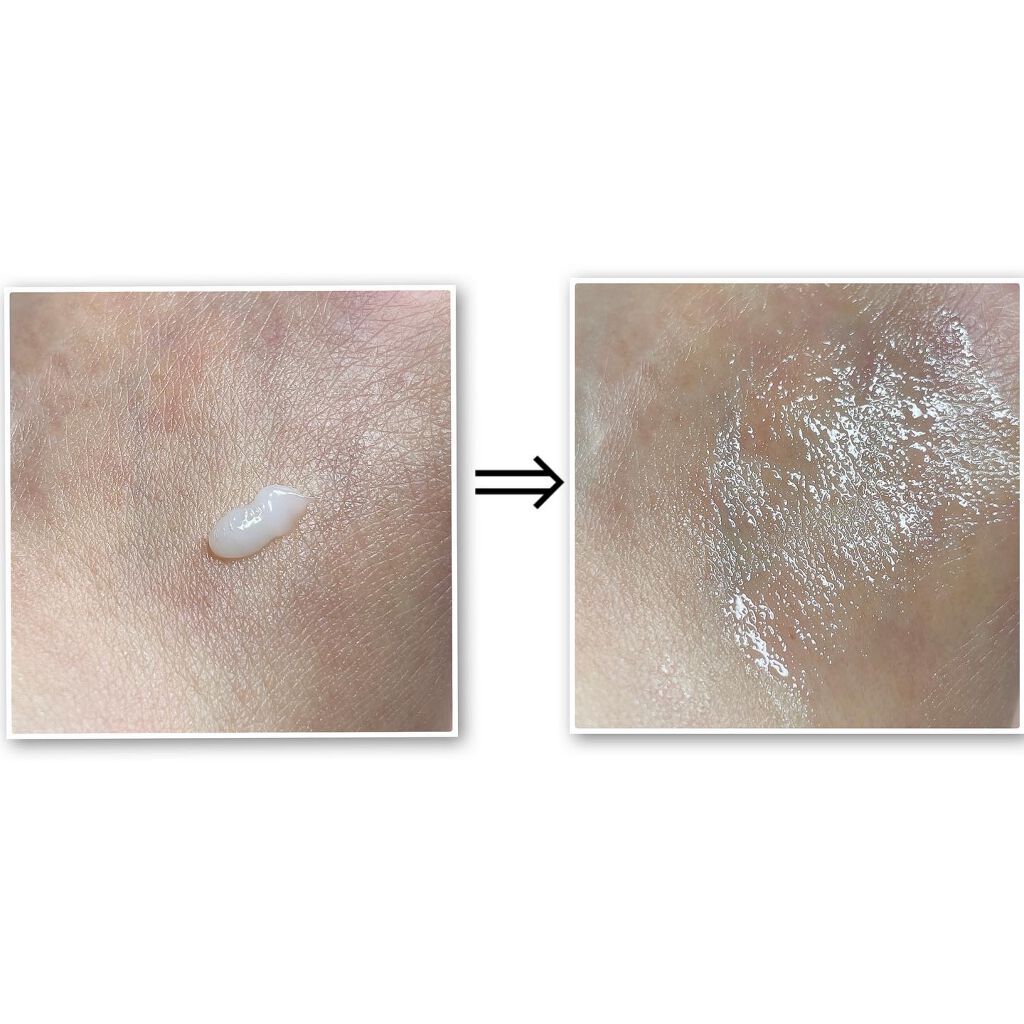 ブレミッシュシールドアンプル/AMIOK/美容液を使ったクチコミ(5枚目)