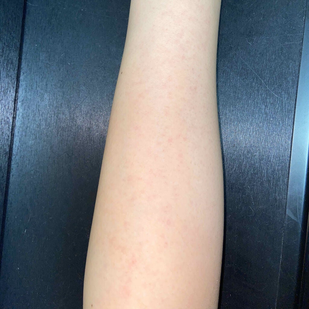 除毛クリーム シトラスホワイトリリィ/スリンキータッチ セルフスパ/除毛クリームを使ったクチコミ(3枚目)