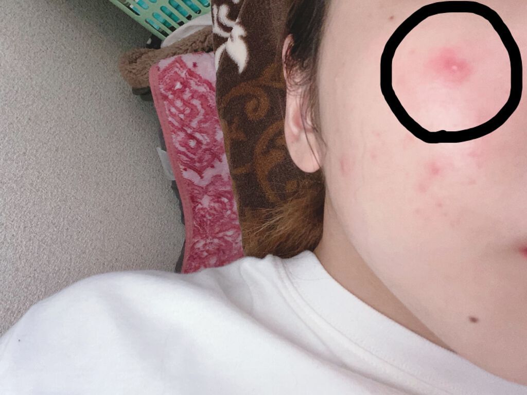 を使ったクチコミ（1枚目）