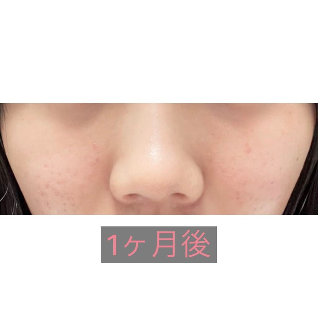 スムースEクリーム/SMOOTH E/フェイスクリームを使ったクチコミ(2枚目)