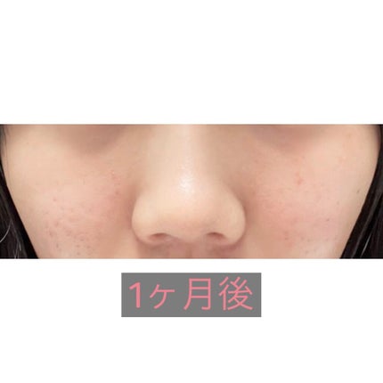 スムースEクリーム/SMOOTH E/フェイスクリームを使ったクチコミ(2枚目)