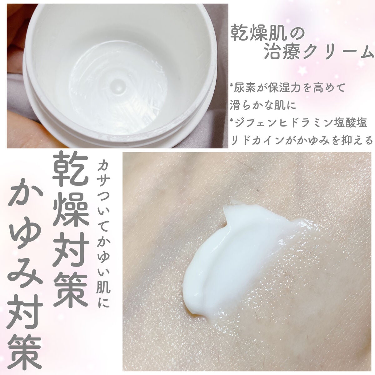 メンタームEXプラスクリーム(医薬品)/メンターム/その他を使ったクチコミ(3枚目)