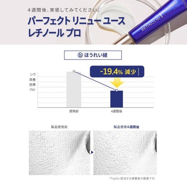 【公式】LANEIGE(ラネージュ) on LIPS 「【シワでお悩みの方は必見‼パーフェクトリニューユースレチノール..」（6枚目）