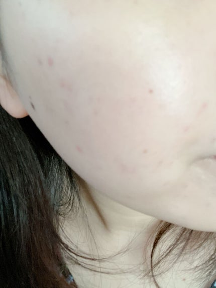 UVイデア XL プロテクショントーンアップ ローズ/ラ ロッシュ ポゼ/日焼け止めクリームを使ったクチコミ(2枚目)