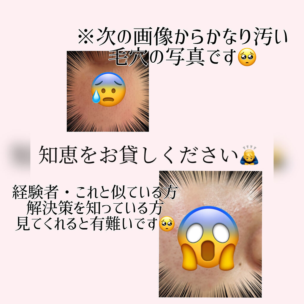 乳液・敏感肌用・しっとりタイプ/無印良品/乳液を使ったクチコミ（1枚目）