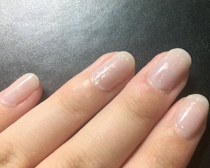 ネイルケアプロテクター クリアブルー/オルビス/ネイルオイル・トリートメントを使ったクチコミ(1枚目)