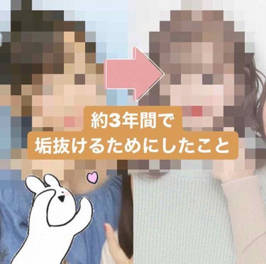 私が約3年間で「垢抜けたね」と言われるまでにしてきたことを紹介しようと思います🌟

2枚目の写真が私のビフォーアフターです😂
左が中学2年生の時のプリクラです
右は現在、高校3年のプリクラです！

笑っ