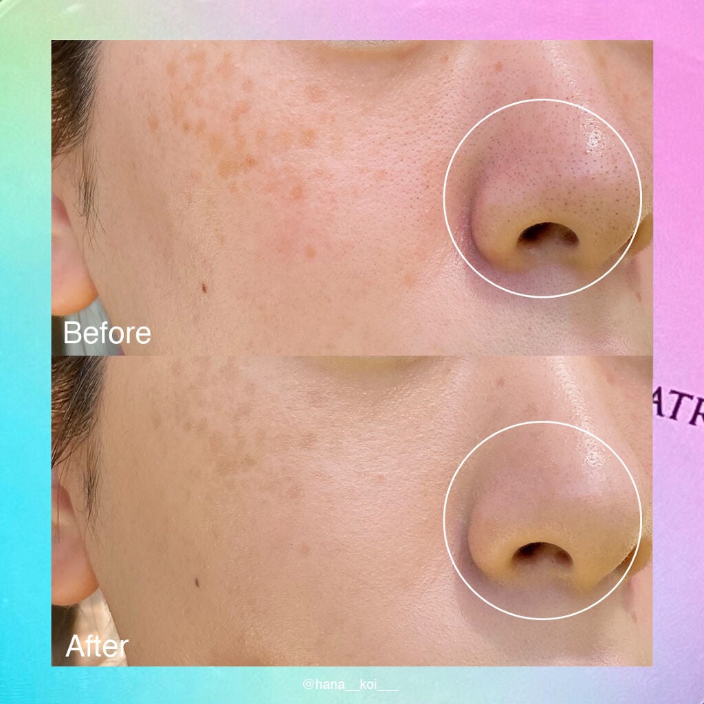 ピンクティーツリーカバークッション/APLIN/クッションファンデーションを使ったクチコミ(3枚目)