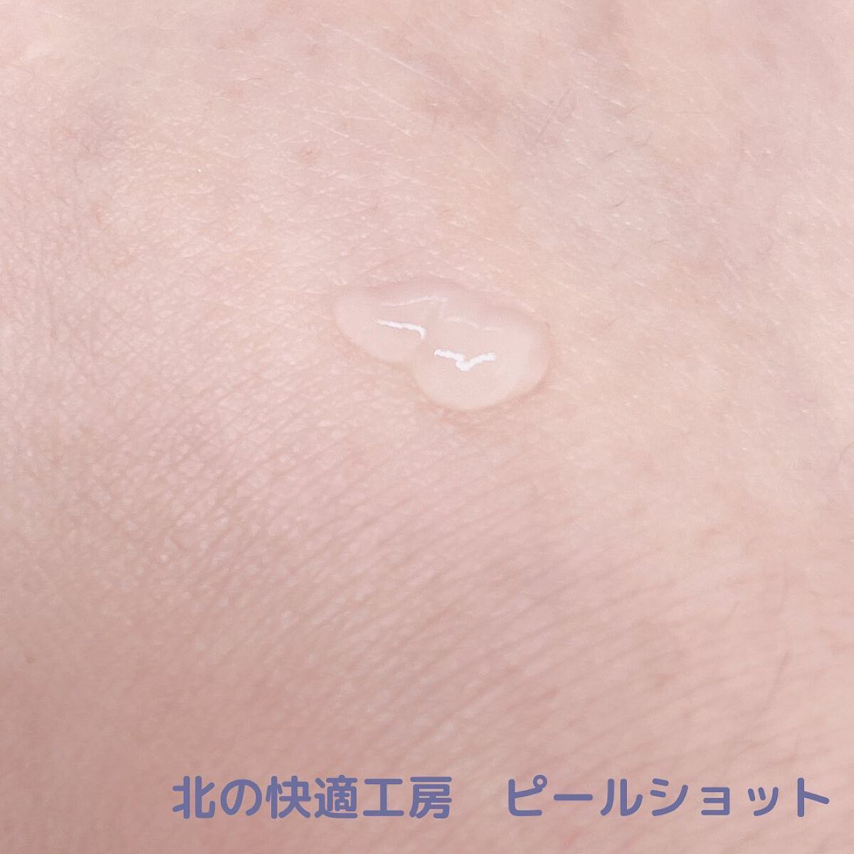 ピールショット/北の快適工房/ピーリングを使ったクチコミ（2枚目）