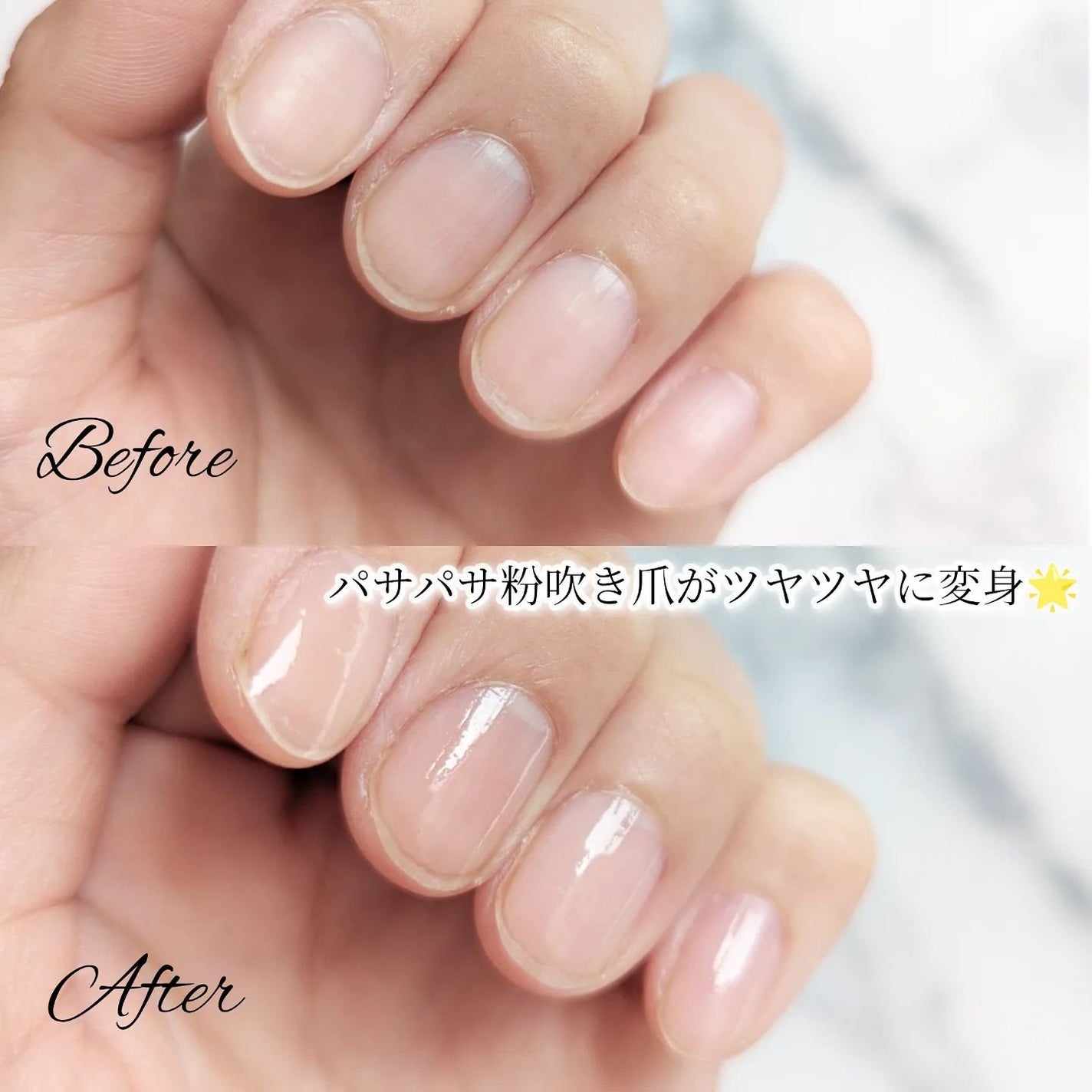 ブルーブライトネイルオイル/EMROSÉ/ネイルオイル・トリートメントを使ったクチコミ(6枚目)