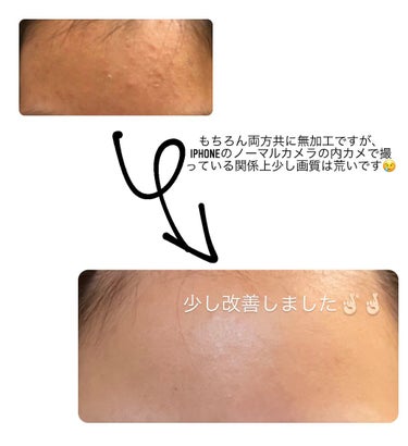 スノー ライト エッセンス ローション (薬用化粧水) (医薬部外品)/Dior/化粧水を使ったクチコミ（1枚目）