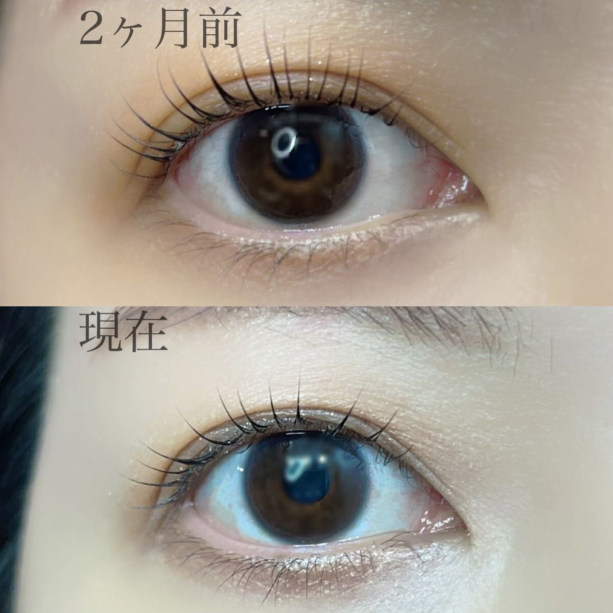 湘南美容まつ毛美容液/Co-medical+/まつげ美容液を使ったクチコミ(2枚目)