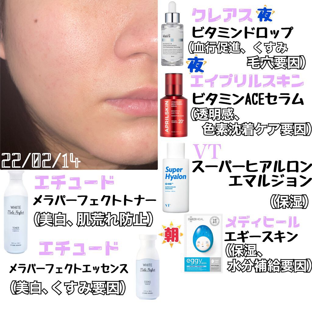 ビタライトビームエッセンシャルマスクEX/MEDIHEAL/シートマスク・パックを使ったクチコミ(3枚目)