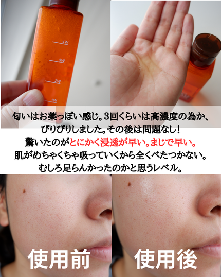 エンリッチ ローション/サイクルプラス/化粧水を使ったクチコミ(5枚目)