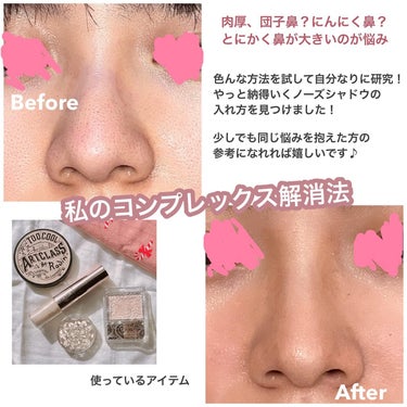 👃

私のコンプレックス解消法！

ある時、友達と映る写真の自分を見てショックな事が😨
それは鼻が大きい事👃😭
団子鼻？にんにく鼻？とにかく大きい。
そこから自分の鼻が嫌になりコンプレックスになりました