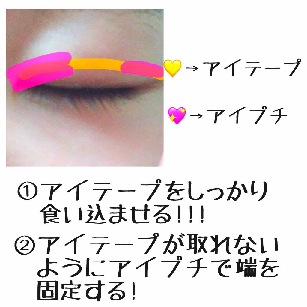 アイトーク/アイトーク/二重まぶた用アイテムを使ったクチコミ(3枚目)