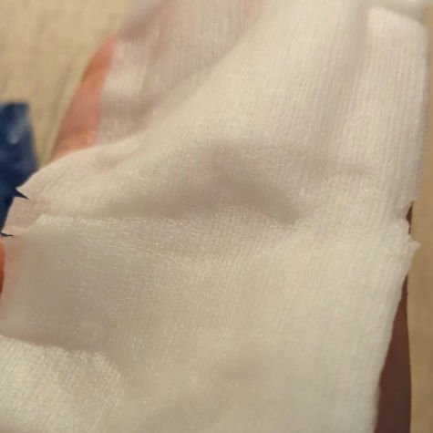 タカミ スキンピールマスク/タカミ/シートマスク・パックを使ったクチコミ（3枚目）