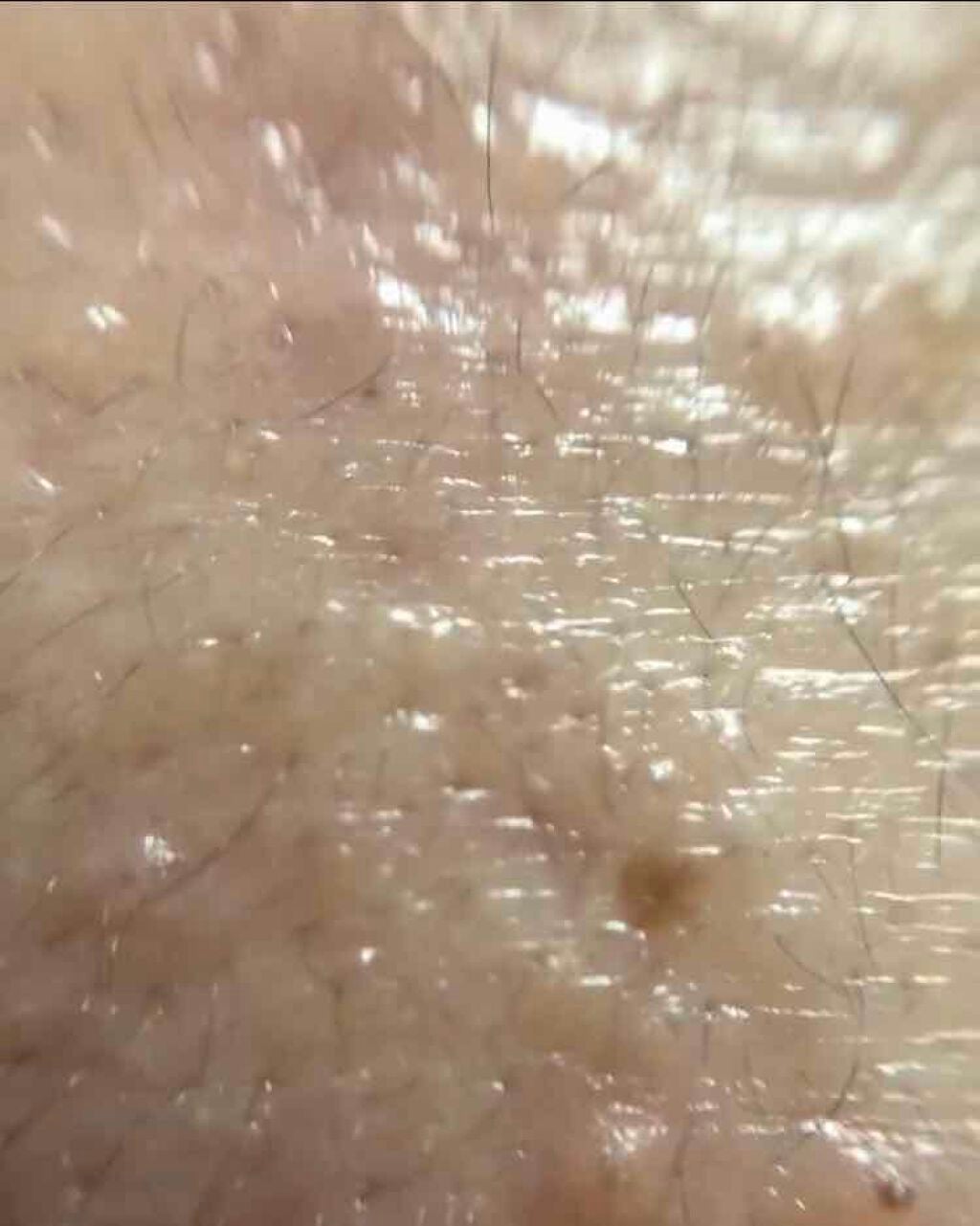 薬用保湿化粧水/オードムーゲ/化粧水を使ったクチコミ(10枚目)